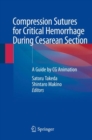 Image for Compression Sutures for Critical Hemorrhage During Cesarean Section : A Guide by CG Animation