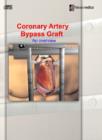 Image for Coronary Artery Bypass Graft : An Overview