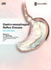 Image for Gastro-Oesophageal Reflux Disease