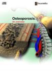 Image for Osteoporosis : An Overview