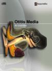 Image for Otitis Media : An Overview