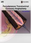 Image for Percutaneous Transluminal Coronary Angioplasty : An Overview