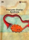 Image for Polycystic Ovarian Syndrome : An Overview