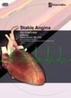 Image for Stable Angina : An Overview