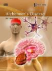 Image for Alzheimer&#39;s Disease : An Overview