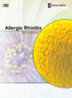 Image for Allergic Rhinitis : An Overview