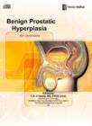 Image for Benign Prostatic Hyperplasia : An Overview