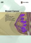 Image for Breast Cancer : An Overview