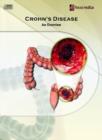 Image for Crohn&#39;s Disease : An Overview