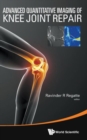 Image for Advanced Quantitative Imaging Of Knee Joint Repair