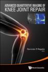 Image for Advanced quantitative imaging of knee joint repair