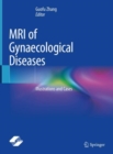 Image for MRI of gynaecological diseases  : illustrations and cases