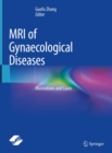 Image for MRI of Gynaecological Diseases: Illustrations and Cases