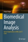 Image for Biomedical image analysis  : special applications in MRIs and CT scans