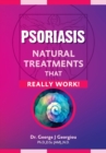 Image for Psoriasis : Natural Treatments That Really Work!