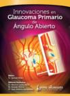 Image for Innovaciones en Glaucoma Primario de Angulo Abierto