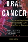 Image for Oral Cancer : Easy And Simplified Strategies to Cure Oral Cancer Forever: Early Detection, Prevention And Treatment
