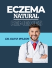 Image for Eczema Natural Remedies