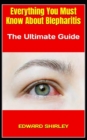 Image for Everything You Must Know About Blepharitis : The Ultimate Guide