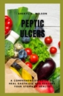 Image for Peptic Ulcers