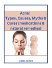 Image for Acne : Types, Causes, Myths &amp; Cures [medications &amp; natural remedies}.