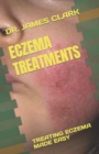 Image for Eczema Treatments : Treating Eczema Made Easy