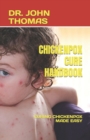 Image for Chickenpox Cure Handbook