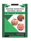 Image for Proven Effective Natural Ways to Treat Eczema