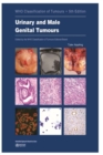 Image for Urinary and Male Genital Tumours