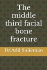 Image for The middle third facial bone fracture