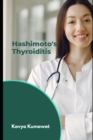 Image for Hashimoto&#39;s Thyroiditis
