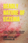 Image for Deadly Nature of Eczema