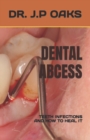 Image for Dental Abcess : Teeth Infections and How to Heal It