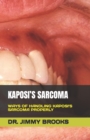 Image for Kaposi&#39;s Sarcoma