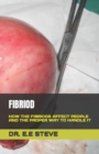 Image for Fibriod