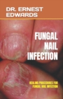 Image for Fungal Nail Infection