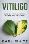 Image for Vitiligo