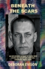 Image for Beneath the Scars : An unflinching account of living with severe self-injury and surviving childhood sexual abuse