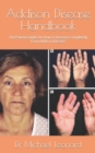 Image for Addison Disease Handbook
