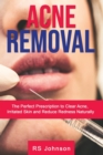 Image for Acne Removal : The Perfect Prescription to clear Acne, Irritated skin and reduce redness naturally