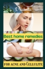 Image for Best home remedies (for acne and Cellulite)