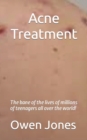 Image for Acne Treatment