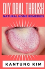 Image for DIY Oral Thrush Natural Home Remedies : The Effective Step By Step Guide To Permanently End Oral Thrush