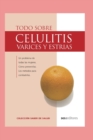 Image for Todo Sobre Celulitis : varices y estrias
