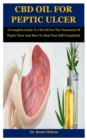 Image for Cbd Oil For Peptic Ulcer