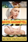 Image for Beste Hausmittel : bei Akne und Cellulite