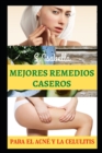 Image for Mejores Remedios Caseros : para el acne y la celulitis