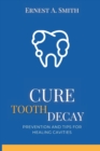 Image for Cure Tooth Decay : Prevention and Tips for Healing Cavities