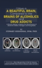 Image for I Have a Beautiful Brain, Compared to the Brains of Alcoholics and Drug Addicts