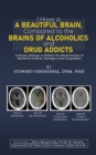 Image for I Have a Beautiful Brain, Compared to the Brains of Alcoholics and Drug Addicts: A Sincere Attempt to Reduce the Attractiveness of Alcohol for Children, Teenagers, and Young Adults
